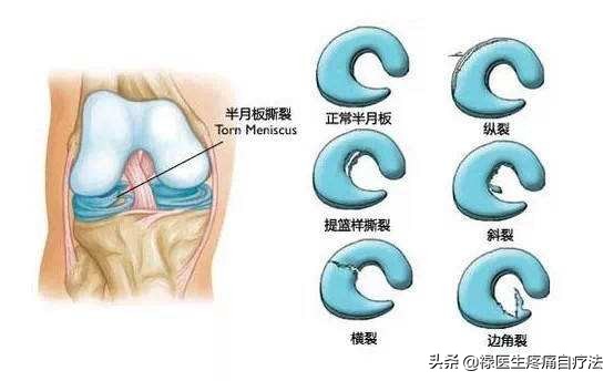 练体育膝盖疼怎么治,最佳精选数据资料_手机版24.02.60